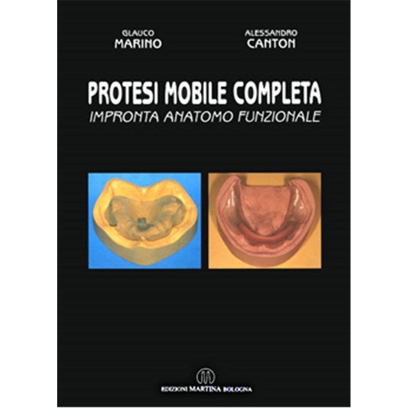 Protesi mobile completa - Impronta anatomo-funzionale
